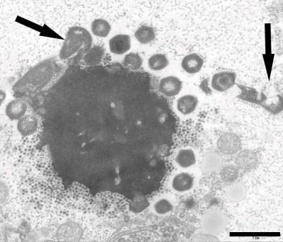 Transmission Electron Microscopy Image of Abnormal Mont1 Virus