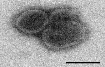 Electron Microscopic Image of Bourbon Virus