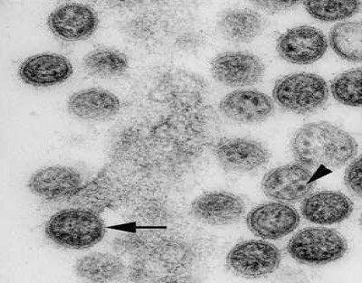 Transmission Electron Micrograph of Cygnet River Virus Infection