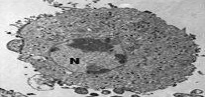 Transmission Electron Micrographs of FHM Cells Infected by FV3