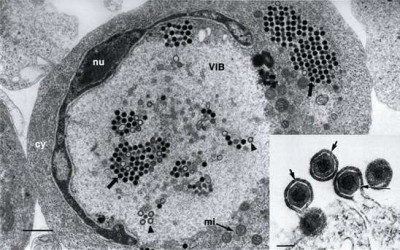 TEM of Fat Head Minnow Cell Infected with ECV