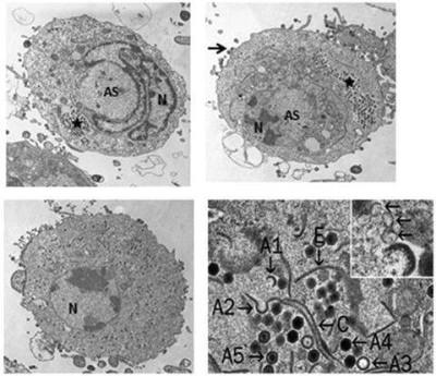 Transmission Electron Micrographs of FV3-Infected FHM Cells