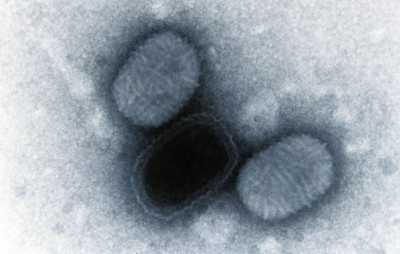 Transmission Electron Micrograph of Molluscum contagiousum Virus