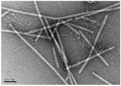 Electron Micrograph Illustration of Viral Particles of a Tobamovirus