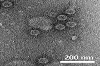 Electron Microscopy of RnPV11 Virions