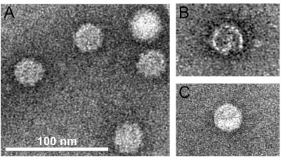 Electron Micrographs of Negatively Stained VLPs Used for Crystallization