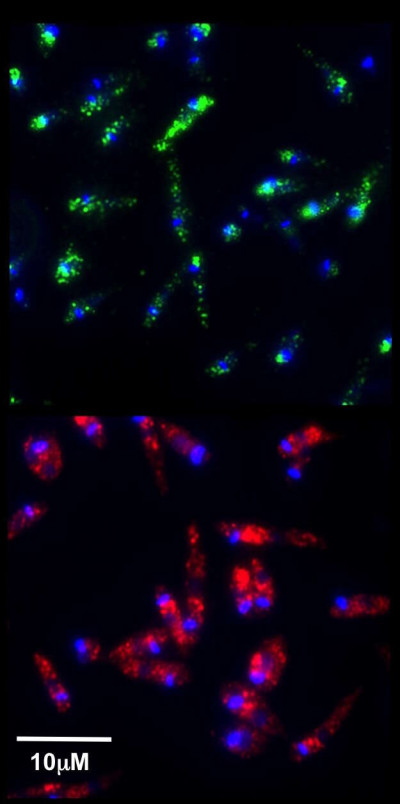 Leishmaniavirus Detected in L. guyanensis Parasites by Immunofluorescence Microscopy