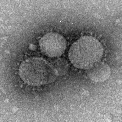 MERS-CoV Electron Micrograph