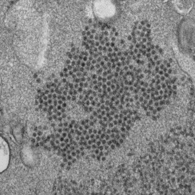 Electron Micrograph of EV-D68 Viral Particles