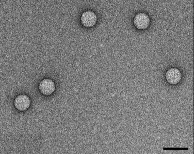 Transmission Electron Microscopy of EV71 Viral Particles