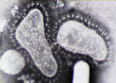 Electron Micrograph of Two Coronaviruses