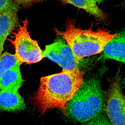 Cells Infected with Langat Virus