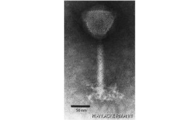 Electron Micrograph of Spounalikevirus