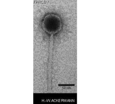 Electron Micrograph of Tunalikevirus