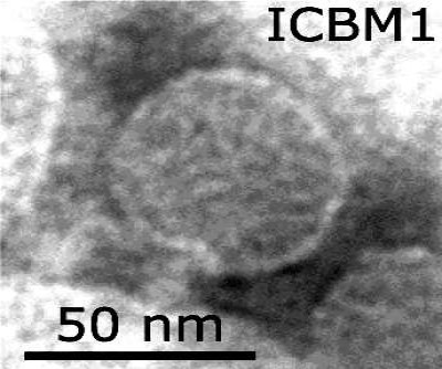 Molybdenum Stained, Cell Debris Bound Lentibacter Virus vB_LenP_ICBM1