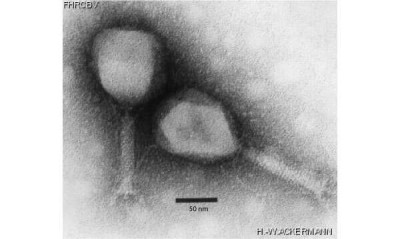 Electron Micrograph of T4likevirus