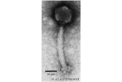 Electron Micrograph of Twortlikevirus