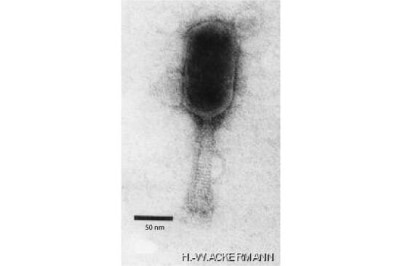 Electron Micrograph of a Virion of Species Schizotequatrovirus