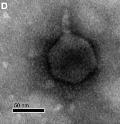 Transmission Electron Microscope Micrograph of Phage RPP1