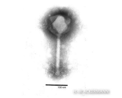 A Virus Particle of the Species Pseudomonas Virus PhiKZ