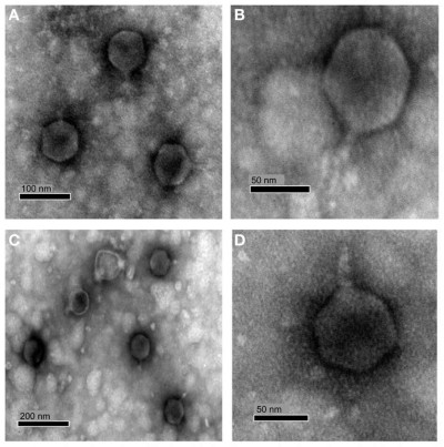 Phages RLP1 and RPP1 Negatively Stained with Uranylacetate