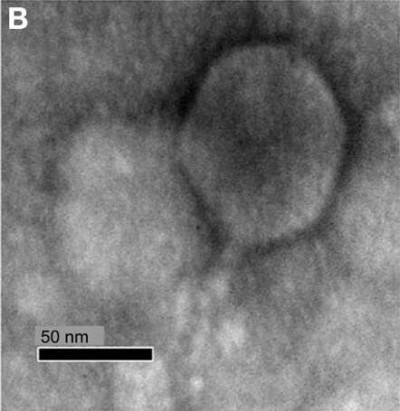 Transmission Electron Microscope Micrograph of Candidate Phage RLP1