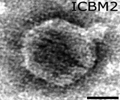 Uranyl Acetate Stained, Free Lentibacter Virus vB_LenP_ICBM2