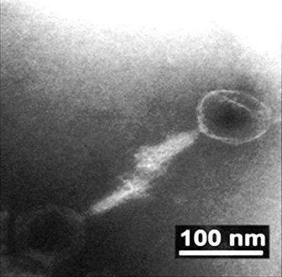 Transmission Electron Microscope Morphology of SH-Ab 15599