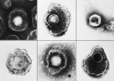 Various Viruses from the Herpesviridae Family