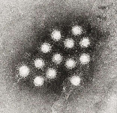 Hepatitis A virus