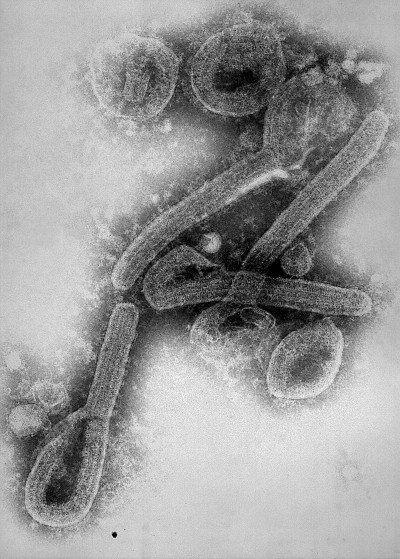 Electron Micrograph of the Marburg Virus