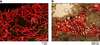 Marburg Virus Particles Budding from Infected Vero E6 Cells