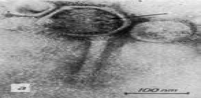 Ultrastructure of PhiKZ Phage Particles