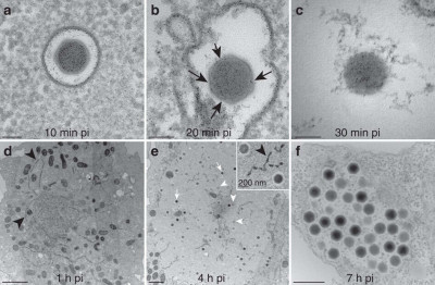 Ultrathin-Section TEM Imaging of Noumeavirus-Infected Acanthamoeba Cells