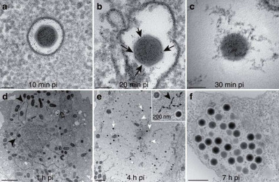 Ultrathin-Section TEM Imaging of Noumeavirus-Infected Acanthamoeba Cells