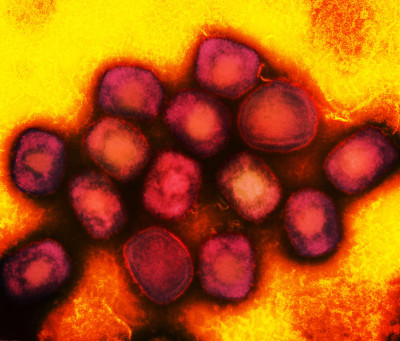 Monkeypox Virus