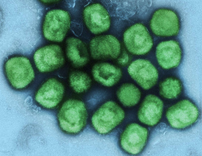 Colorized Tansmission Electron Micrograph of Monkeypox Virus Particles (Green)