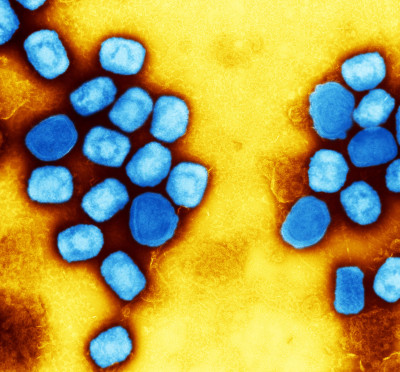 Monkeypox Virus