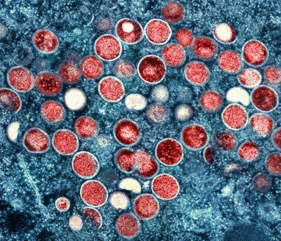 Mpox Virus