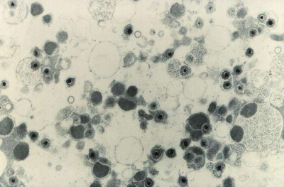 Numbers of Cytomegalovirus Virions