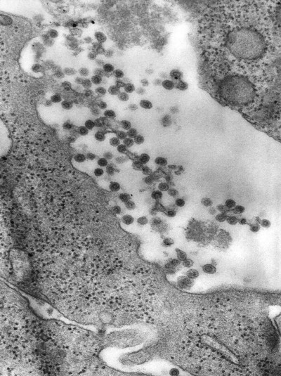 Rubella Virus