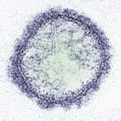 Schmallenberg Virus