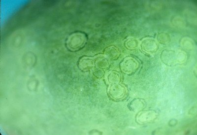 Papaya Ringspot Virus