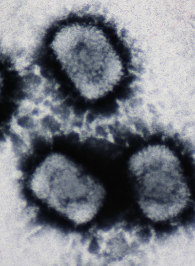 Cowpox Virus