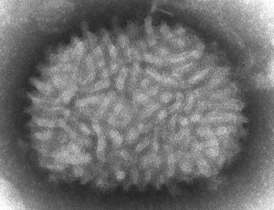 Vaccinia Virus