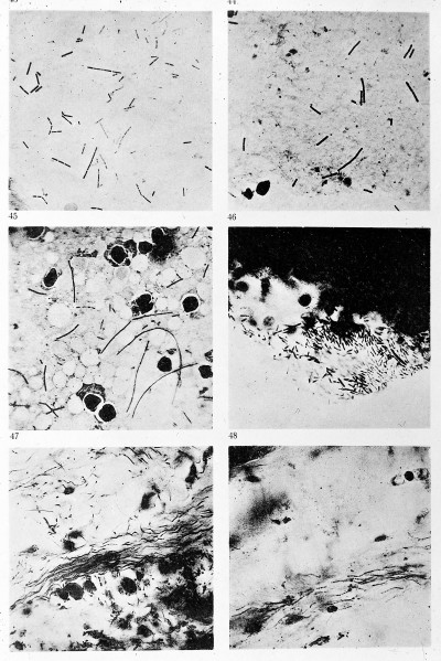 Bacilli of Dema and in Cornea of Pox in Sheep