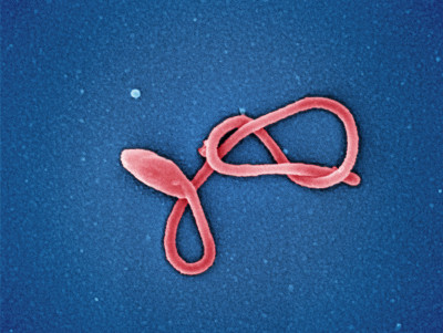 Ebola Virus Particle