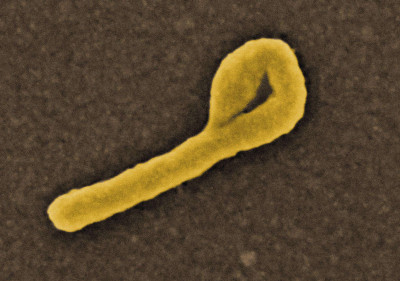 Ebola Virus