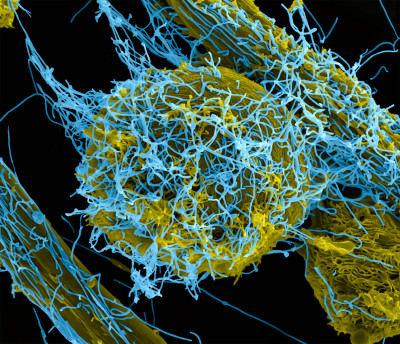 Ebola Virus Particles