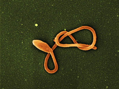 Ebola Virus Particle